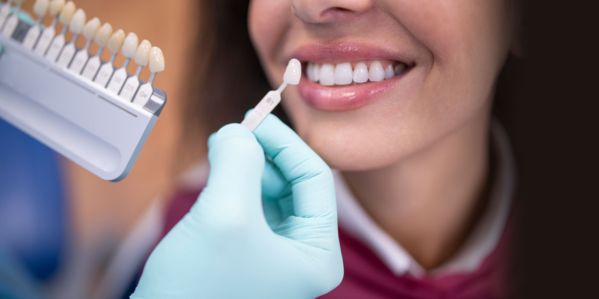 crowns-header-2 Dental Crowns