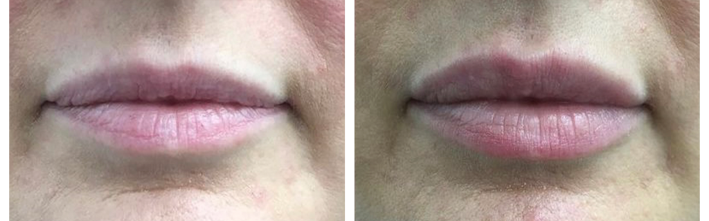 BA Facial Aesthetics