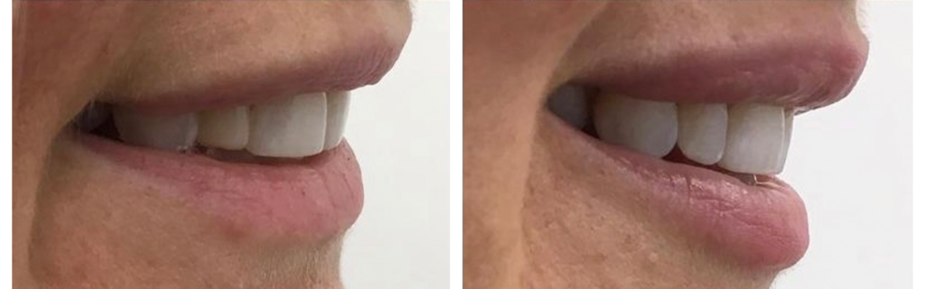 Before and After Facial Aesthetics