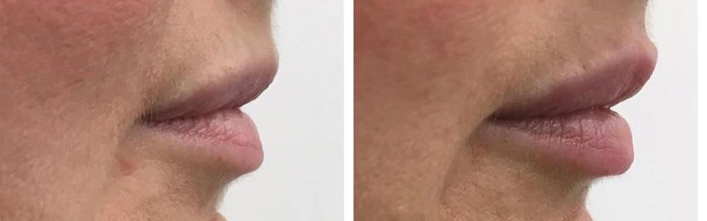 Before & After Facial Aesthetics