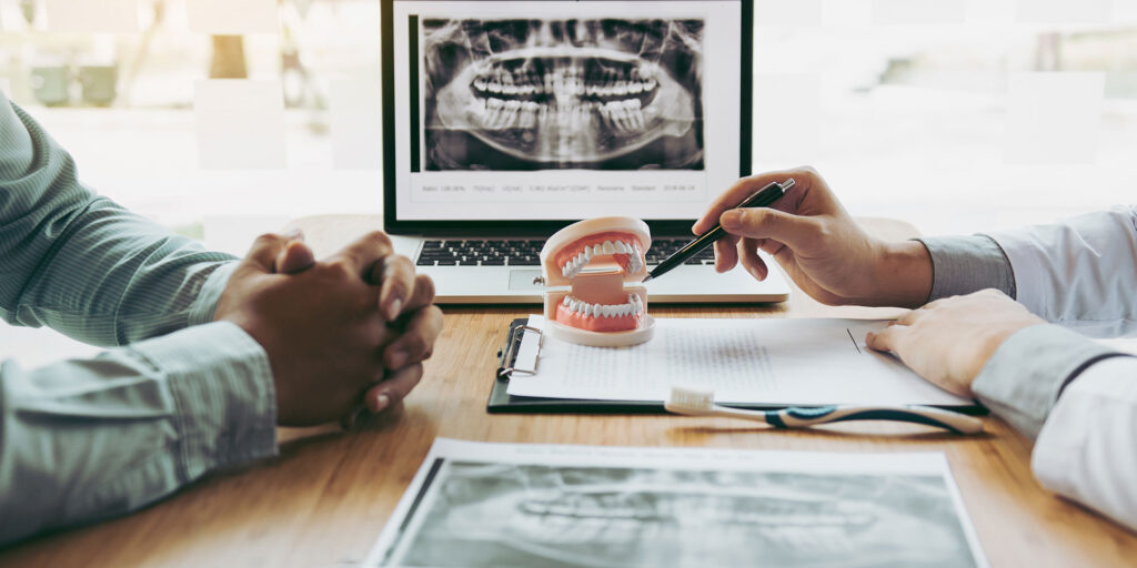 sd-3 composite bonding