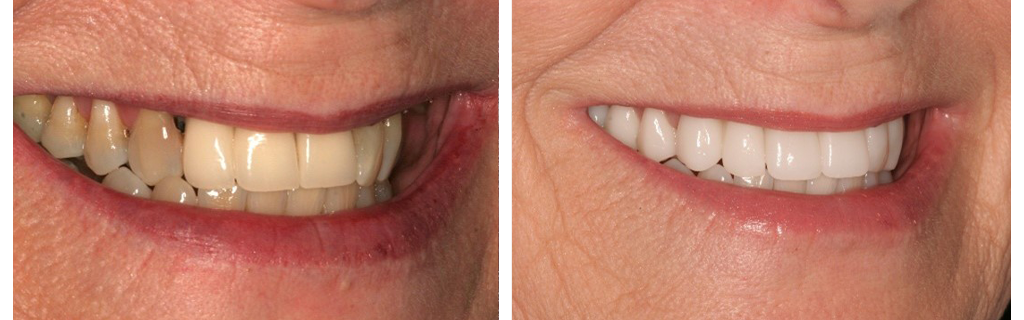 smile-makeovers-1-1024x320-copy copy