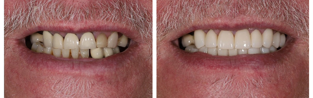 smile-makeovers-1-1024x320 copy