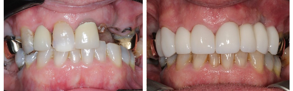 smile-makeovers-4-1024x320 copy